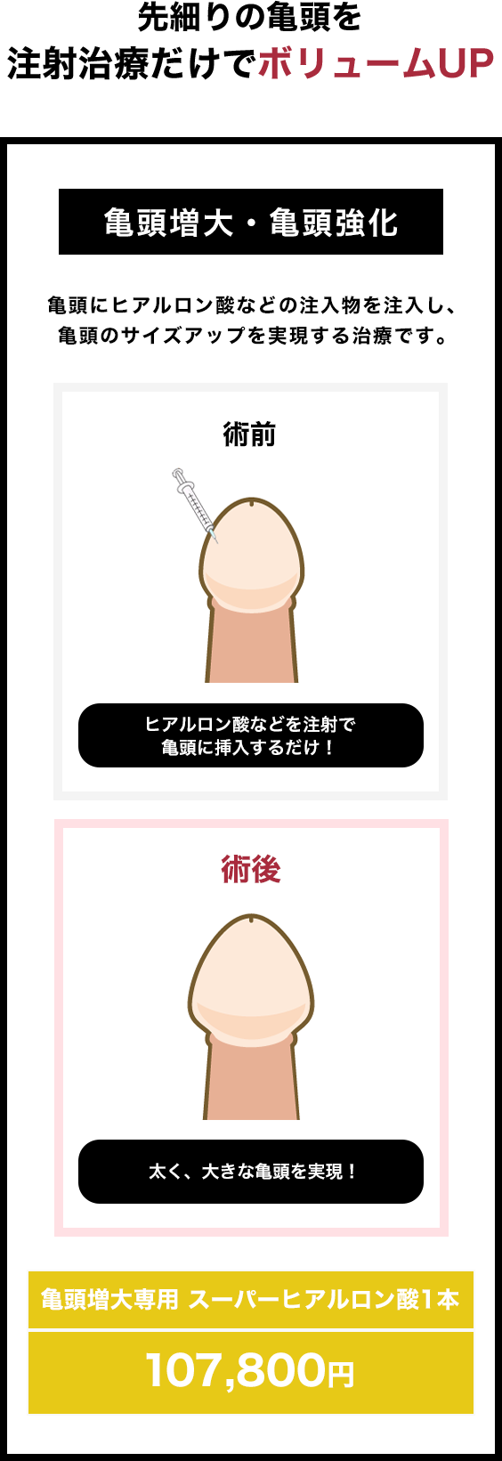先細りの亀頭を注射治療だけでパワーアップ
