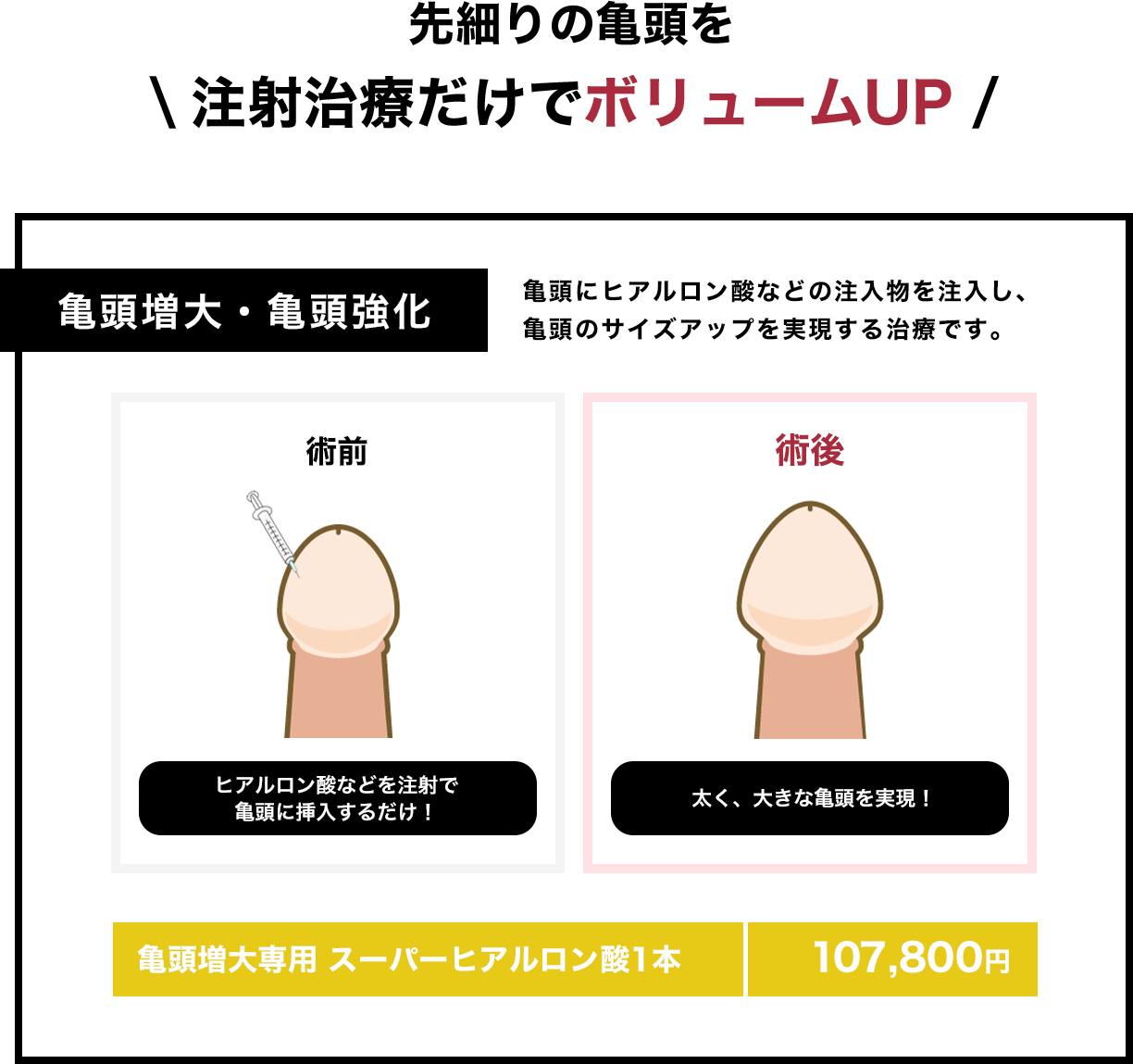 先細りの亀頭を注射治療だけでパワーアップ