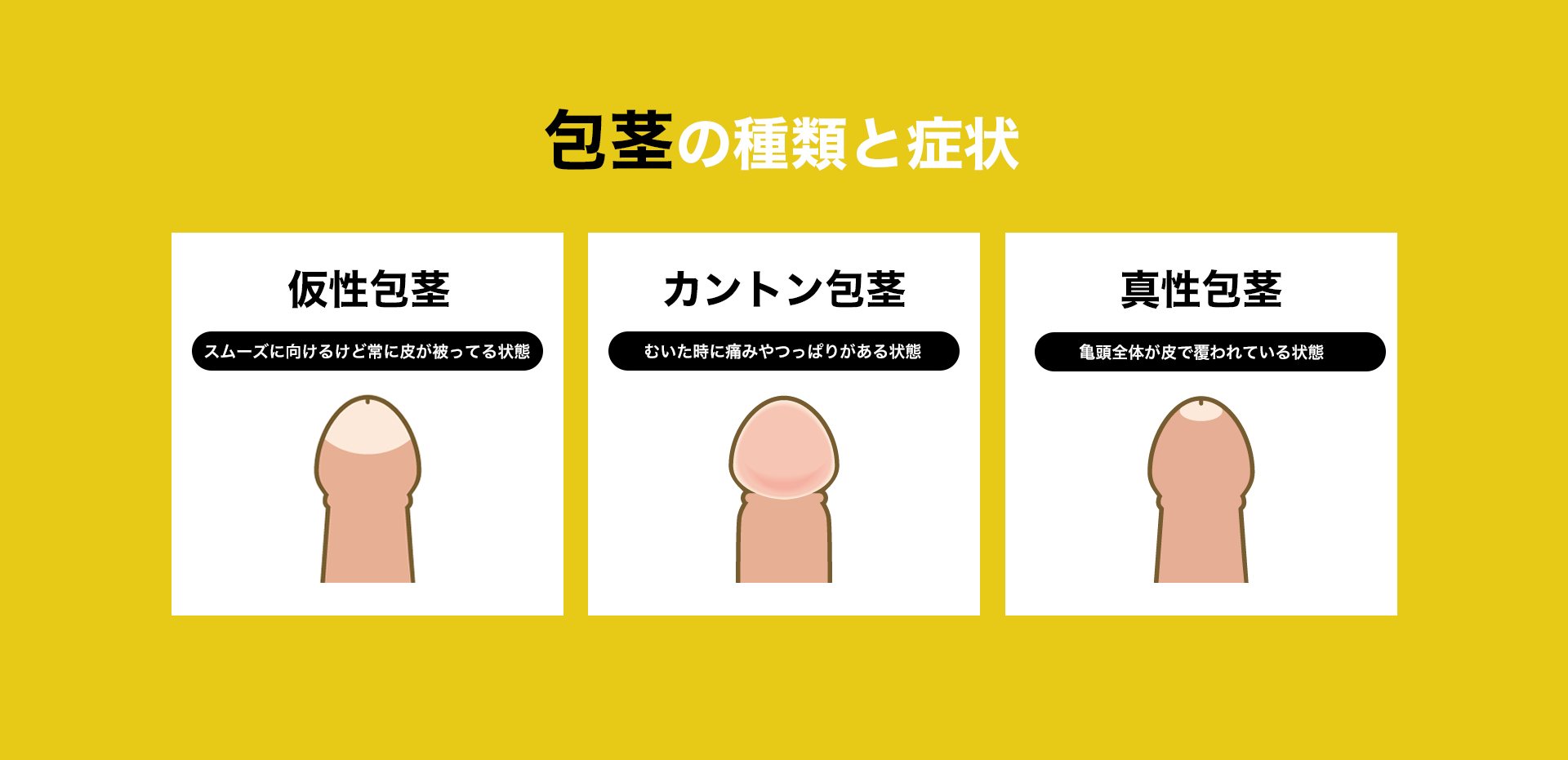 包茎治療の種類